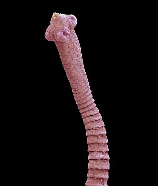 Flea tapeworm, SEM C016  /  9034