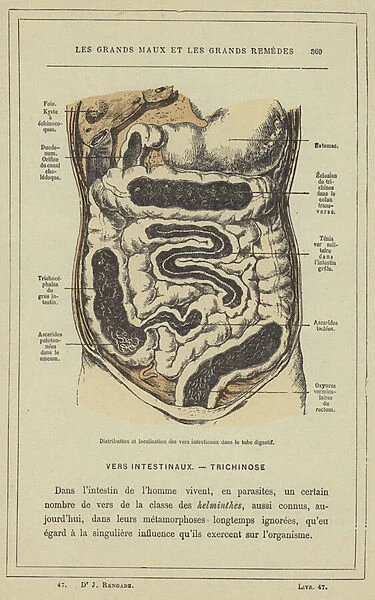 Distribution et localisation des vers intestinaux dans le tube digestif (colour litho)