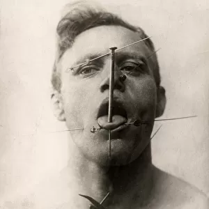 A German Fakir - man undergoing extreme accupuncture