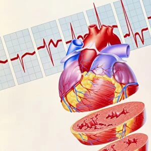 Artwork of heart & ECG trace in heart failure