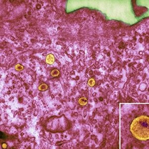 HIV particles in infected cell, TEM