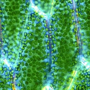Moss leaf cells, light micrograph