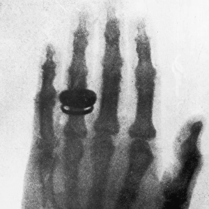 Early X-Ray