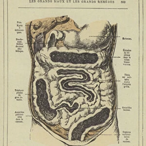 Distribution et localisation des vers intestinaux dans le tube digestif (colour litho)