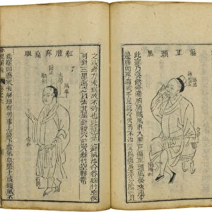 Shen Shi Yao Han (A Precious Book of Ophthalmology), 1644. Artist: Fu Renyu (active Mid of 17th cen. )